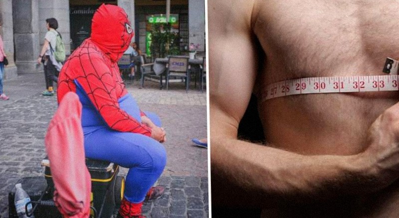 Obezita nám môže skrátiť dĺžku života až o 10 rokov